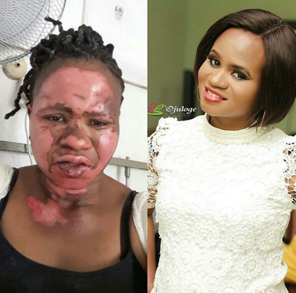 Penelope Grape Mathis The Power of Makeup to Transform! Makeup Artist of Sojuloge Makeover Proves  there is Beauty in Scars | BellaNaija